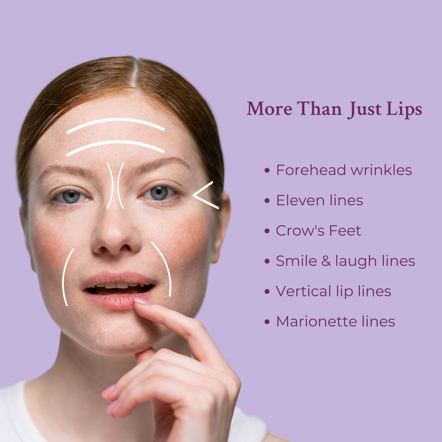 Ageless Lip & Line Filler
